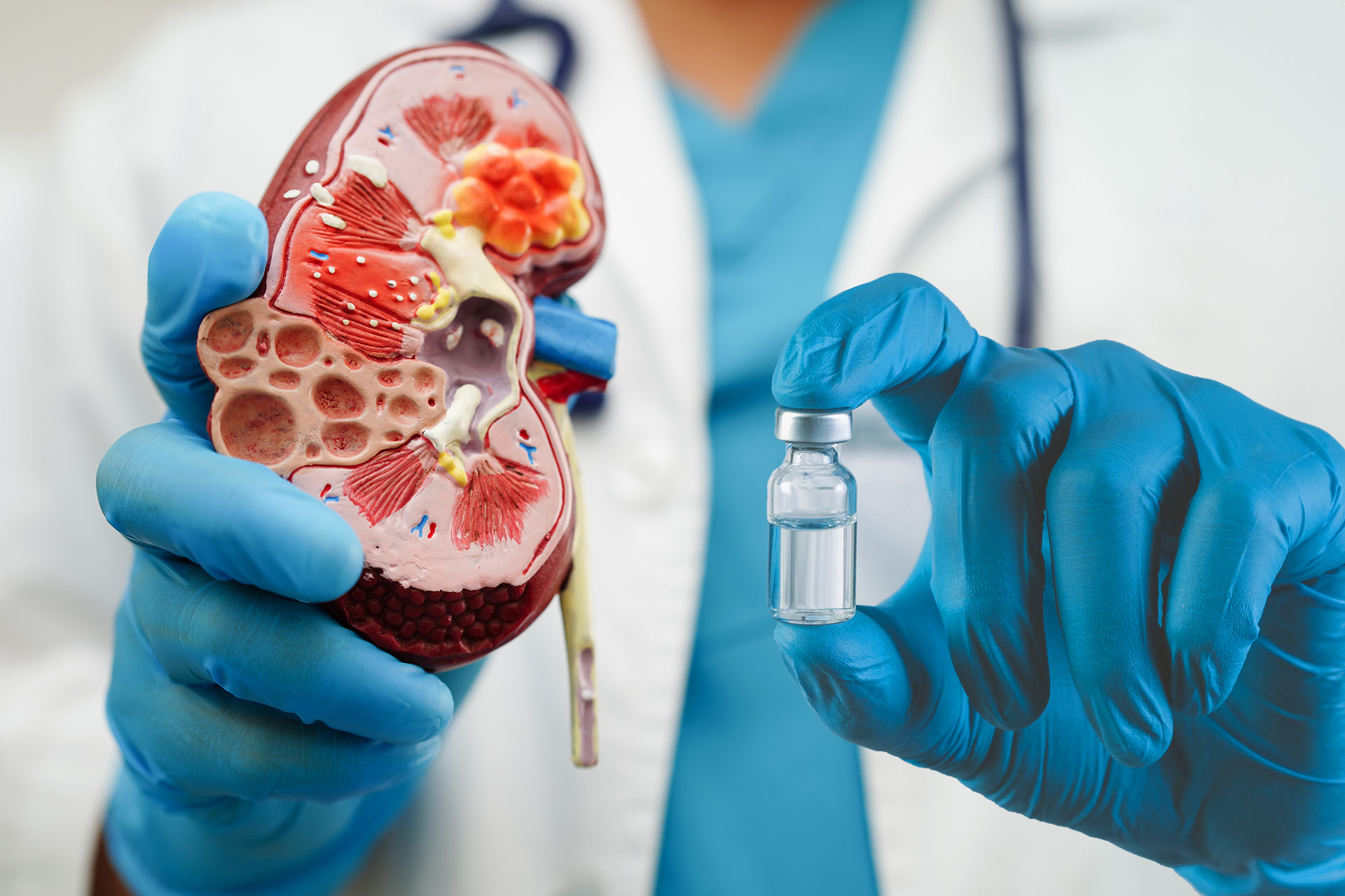 اكتشاف ثوري: مؤشر حيوي جديد للتنبؤ بالفشل الكلوي المزمن وعلاجه