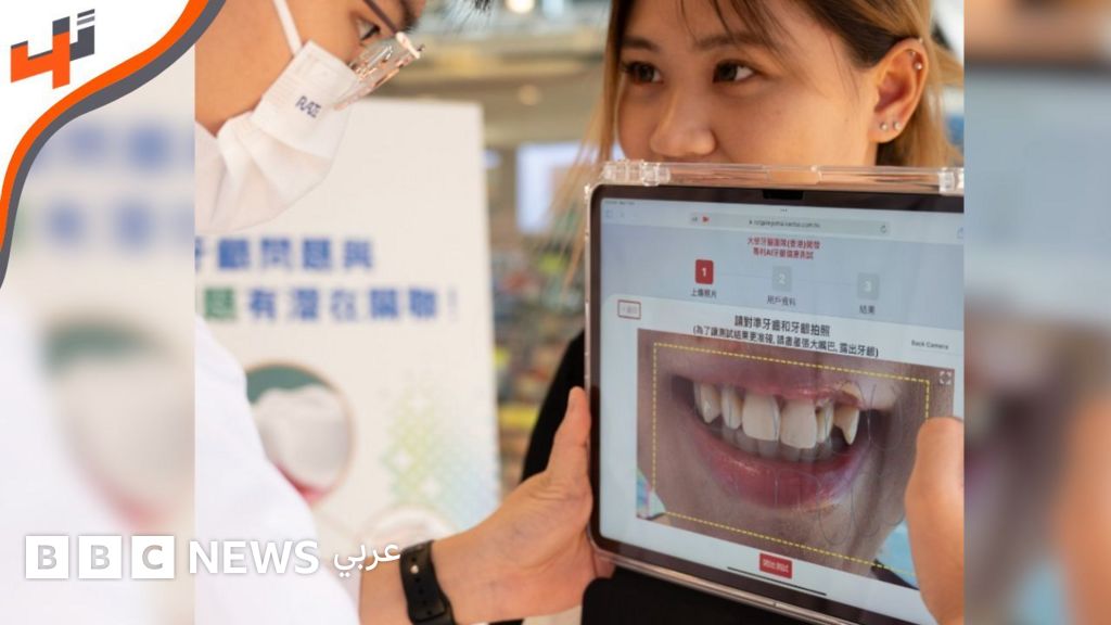 ثورة في طب الأسنان المنزلي: تطبيق Dentomi يستخدم الذكاء الاصطناعي لفحص صحة الفم عبر الهاتف