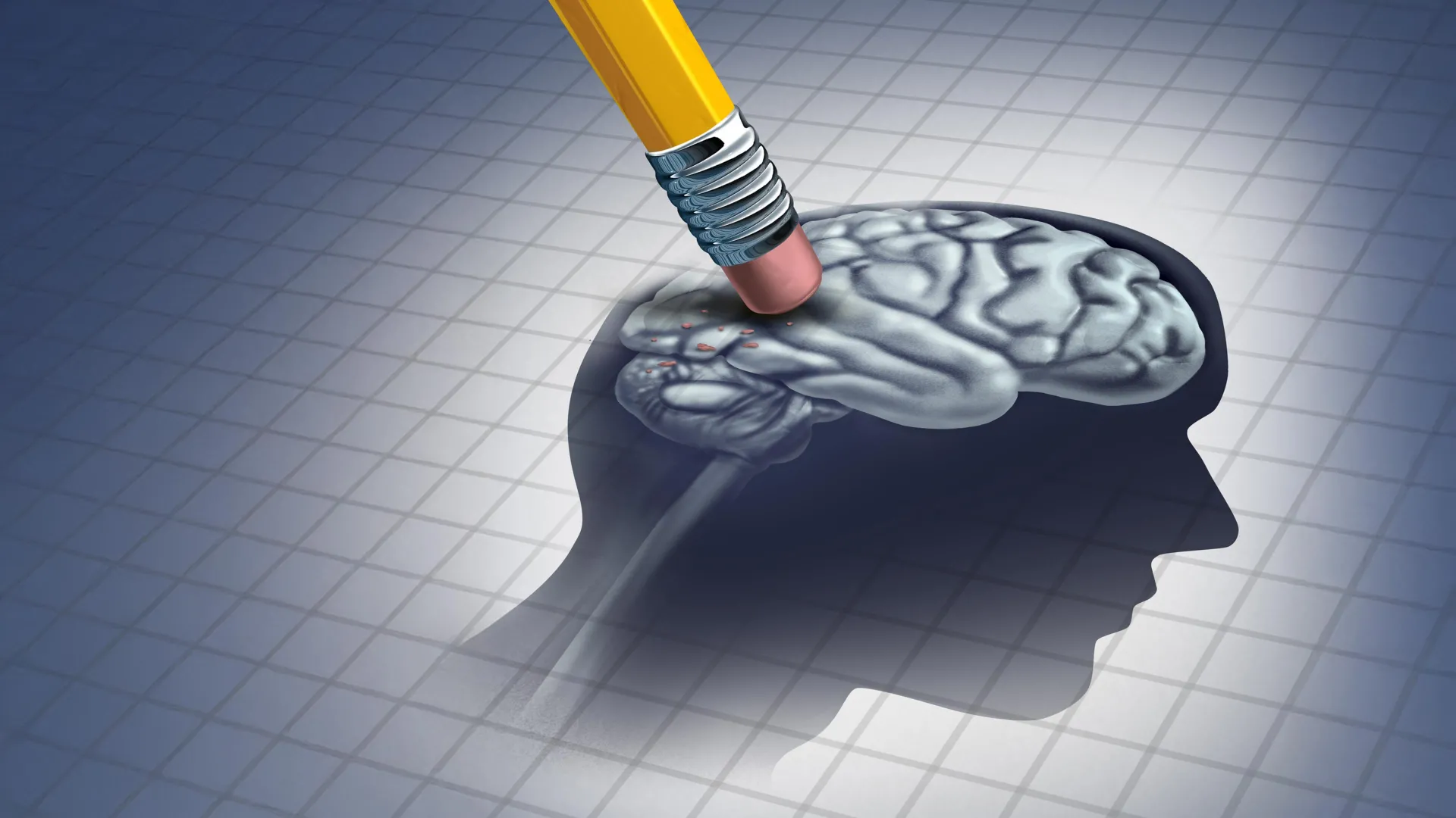 آليات جزيئية جديدة: كيف يحفز مرض ألزهايمر الدماغ على تدمير روابطه العصبية؟