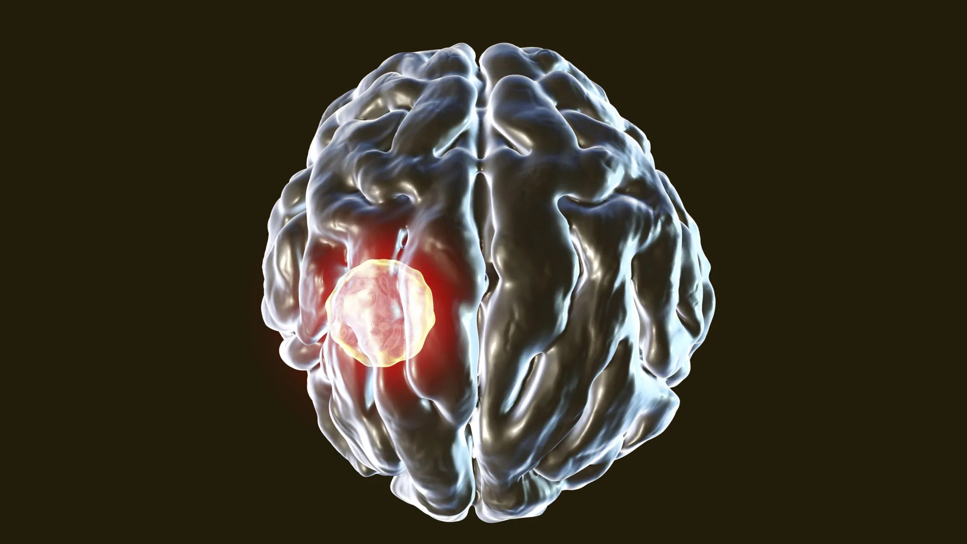 دراسة جديدة تكشف عن “مفتاح تدمير ذاتي” يحمي الدماغ من طفيلي التوكسوبلازما