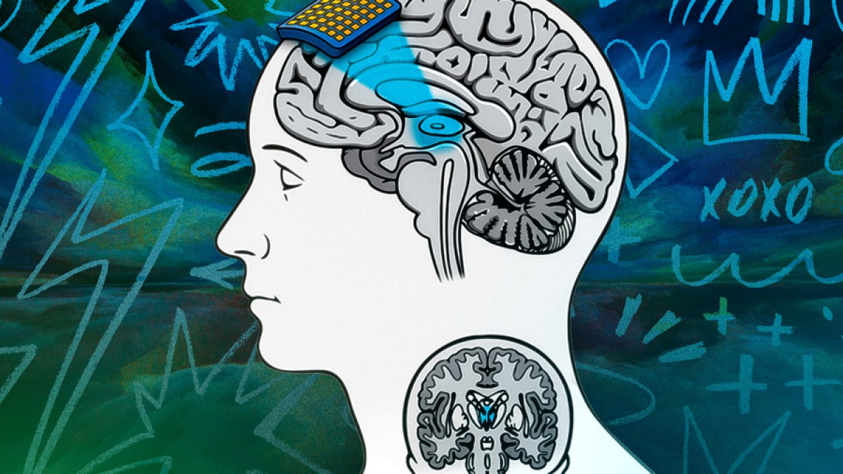 ثورة في علم الأعصاب: كيف يخطط معهد ماساتشوستس لفك لغز الوعي البشري؟