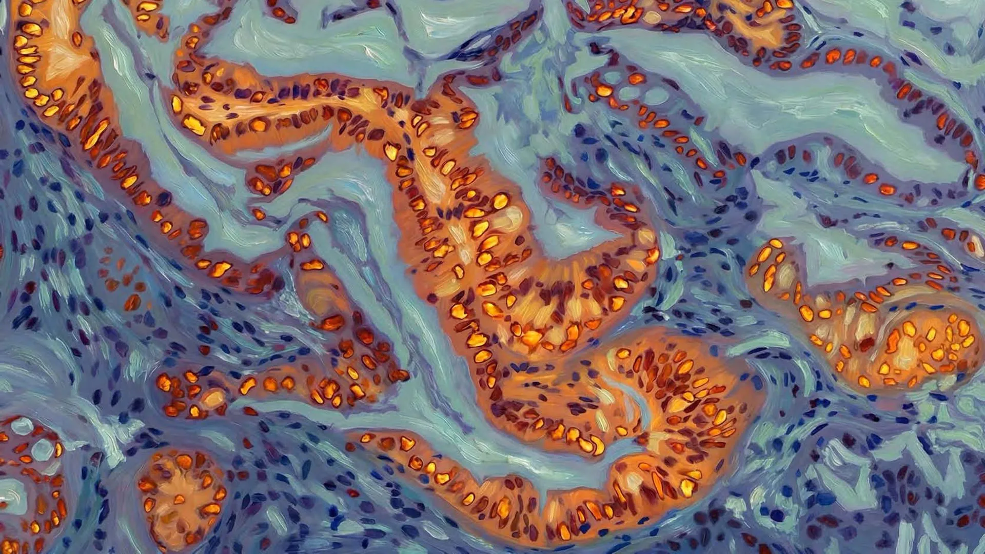 سرطان البنكرياس والمقاومة الدوائية