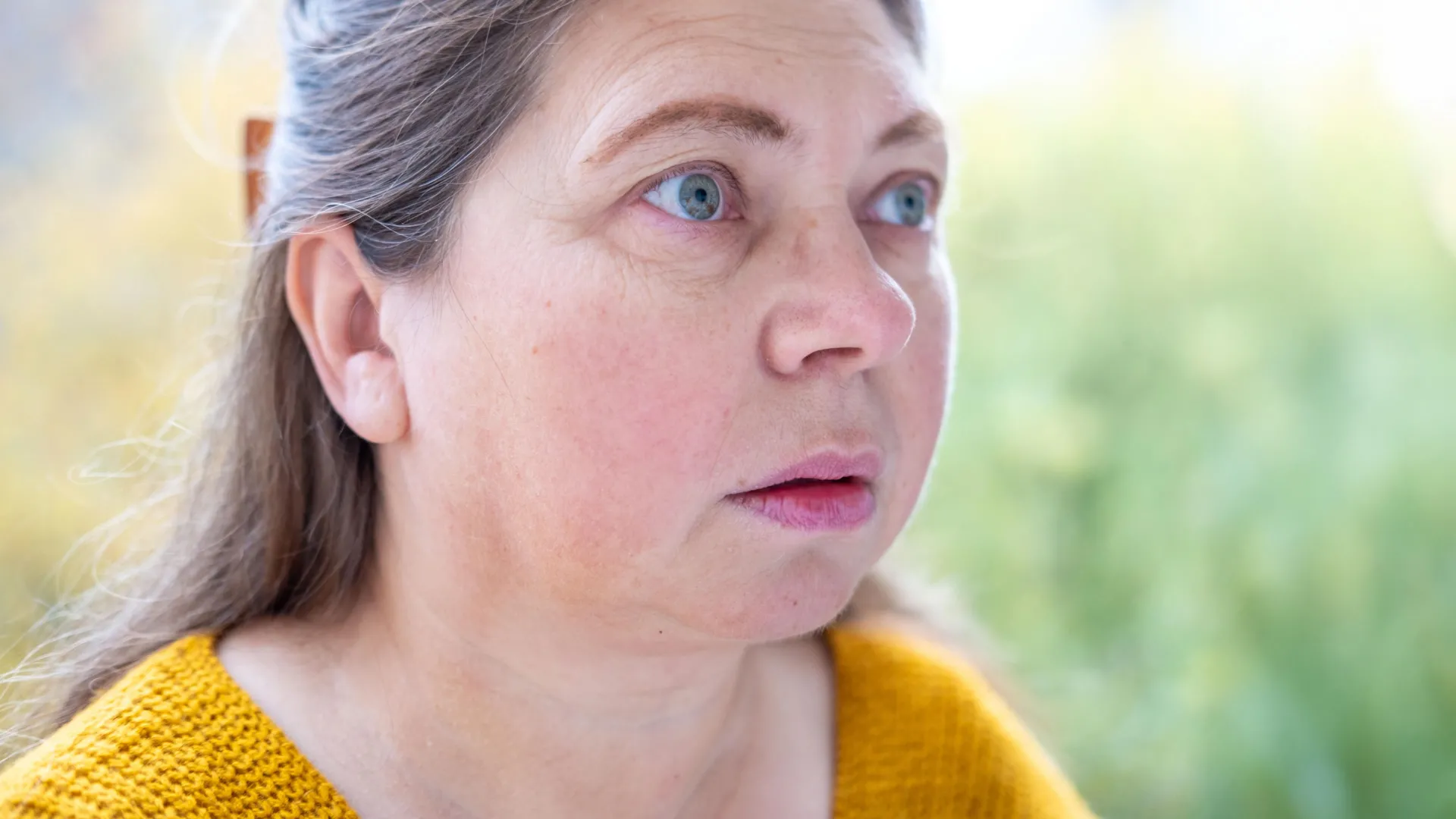 السمنة الساركوبينية