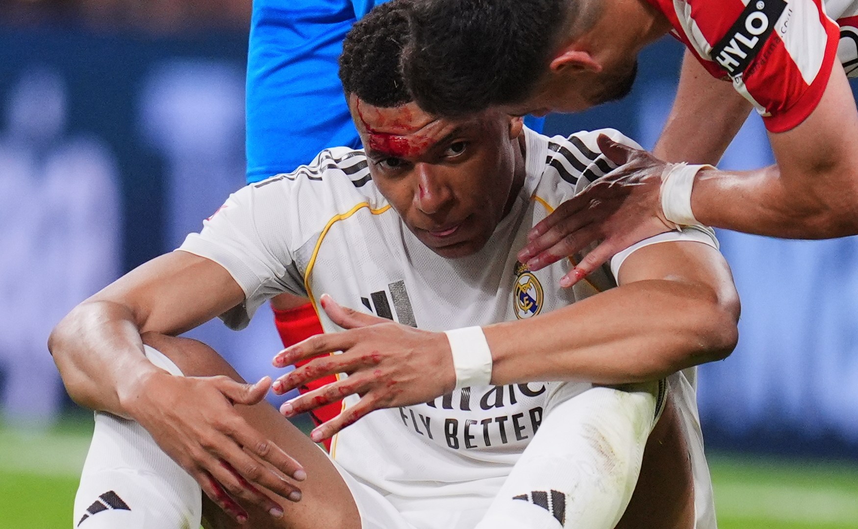 هل يغيب عن قمة بايرن ميونخ؟ تفاصيل إصابة كيليان مبابي وموقف ريال مدريد الرسمي